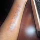 Medium Tattoo