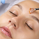 Acne Treatment