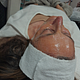Tratamiento antiage