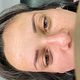 Microblading