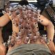 Cupping massage