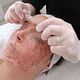 Facial Limpieza Profunda