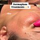 Dermaplane Treatment