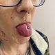 Tongue
