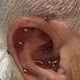 Anti-Tragus