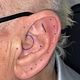 Ear design Consultation