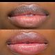 Dark Lip Neutralisation
