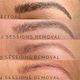 Brow Correction