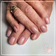 T-gel nude nabehandeling