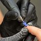 Nail removal (by someone else)