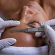 Dermaplaning