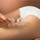 Cupping