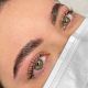 Brow lift