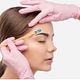 Depilación facial
