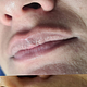 Neutralización de labios oscuros