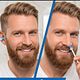 Neus- & oorontharing met wax