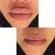 Lip thread
