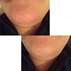 Chin thread
