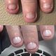 Nail Reset Program (voor nagelbijters)