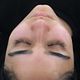 Microdermabrasion Facial