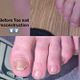 foot re construction