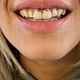 Smiley