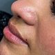 Beautymark PMU