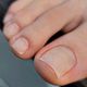 GESPECIALISEERDE PEDICURE