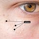 Facial especial Miliums