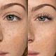 Lash Lifting