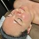Higiene profunda + Dermaplaning