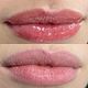 Hidra Gloss Lips