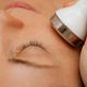 Electroporación facial