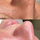 Higiene facial profunda