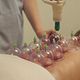 Cupping massage