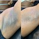 Lightening treatments for any part of body 3 treatments