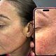 Mini facial