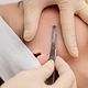 Dermaplane