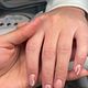 Gelnagels