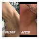 Under arm wax