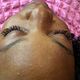 Hybrid lash set