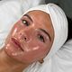 Microneedling X Peeling
