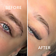 Brow shaping