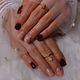 Short nail