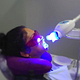 TEETH WITHENING