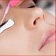 Lash Removal