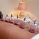Cupping massage