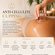 Anti-cellulitis cupping – 30 min