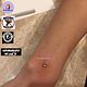 Dermal