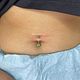 Navel